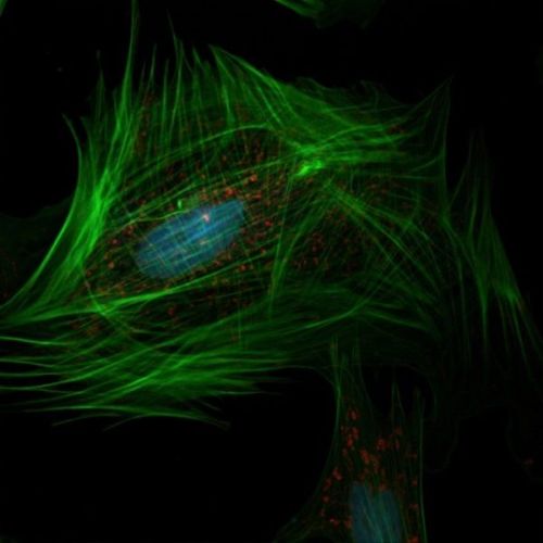 Weak RF Effects on Chemical Parameters That Characterize Oxidative Stress in Human Fibrosarcoma and Fibroblast Cells