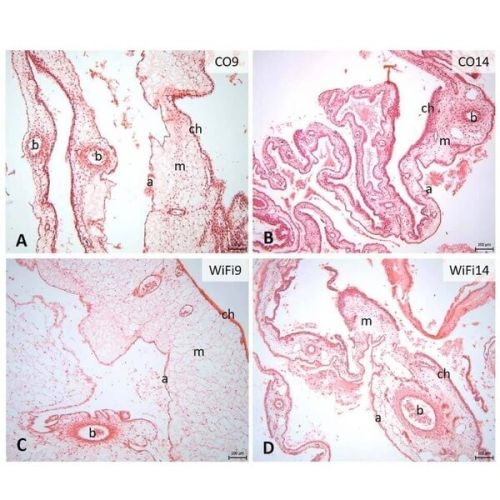 The effect of Wi-Fi on elastic and collagen fibres in the blood vessel wall