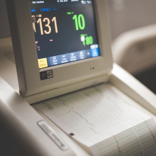 Heart rate variability