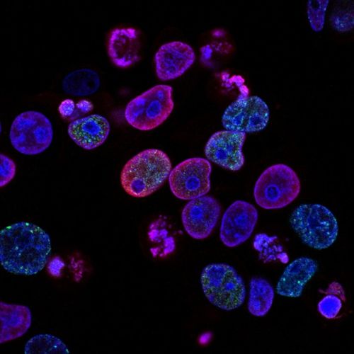 olorectal cancer cells