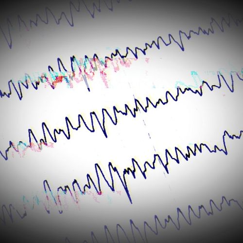 Effects of mobile phone electromagnetic fields on brain waves in healthy volunteers
