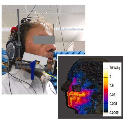 Mobile phone specific radiation disturbs cytokinesis and causes cell death